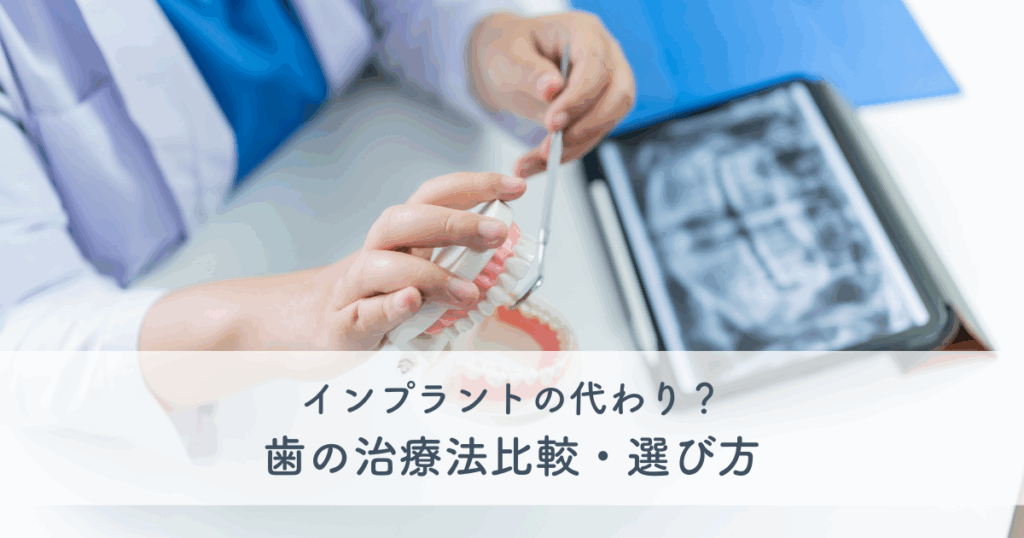 インプラントの代わり？歯の治療法比較・選び方