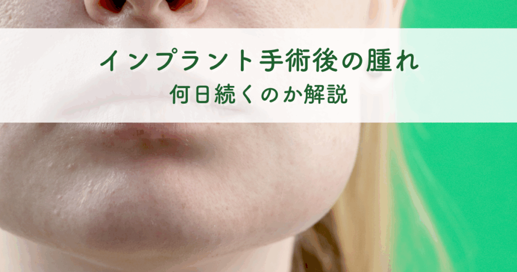インプラント手術後の腫れは何日続くのか徹底解説！