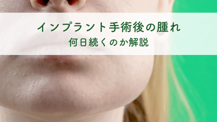 インプラント手術後の腫れは何日続くのか徹底解説！
