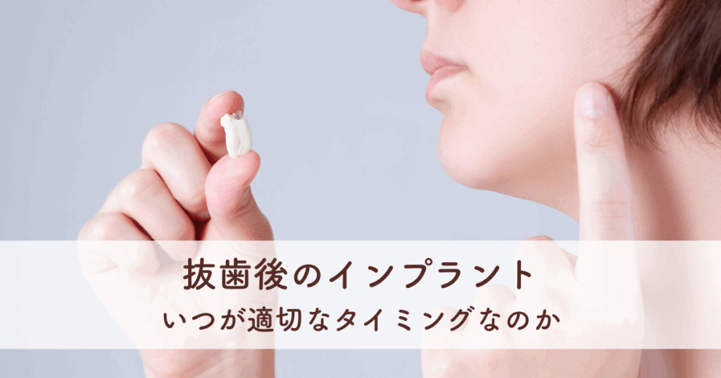 抜歯後のインプラントはいつが適切なタイミングなのか徹底解説！