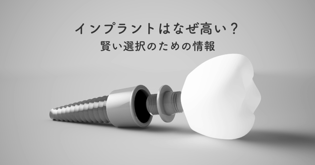 インプラントはなぜ高い？賢い選択のための情報