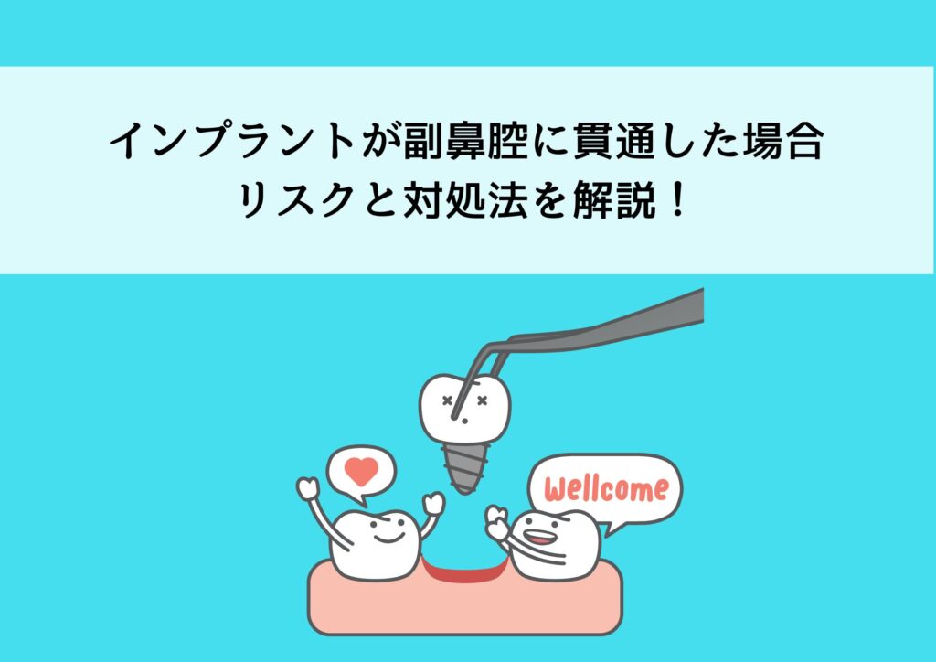 インプラントが副鼻腔に貫通した場合のリスクと対処法を解説！