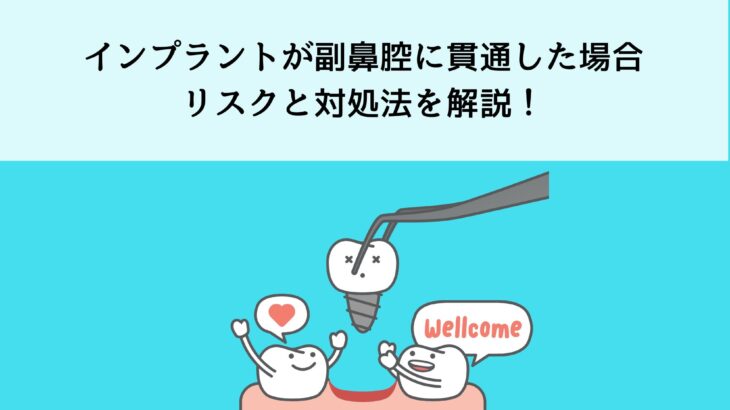 インプラントが副鼻腔に貫通した場合のリスクと対処法を解説！