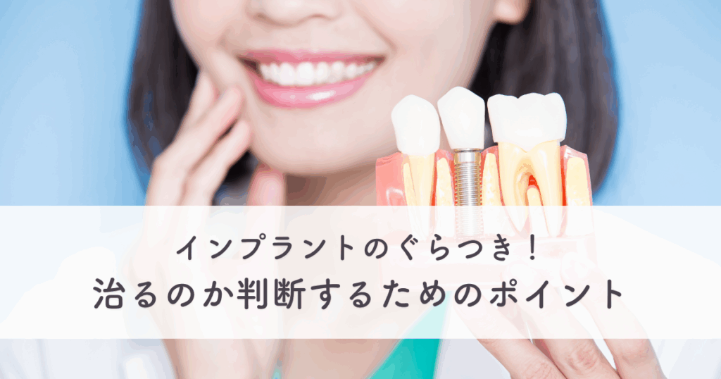 インプラントのぐらつき！治るのか判断するためのポイント