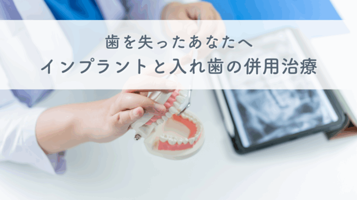 歯を失ったあなたへ・インプラントと入れ歯の併用治療を選択すべきか？