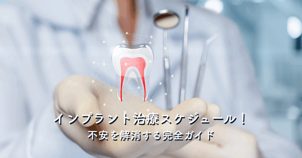 インプラント治療スケジュール！不安を解消する完全ガイド