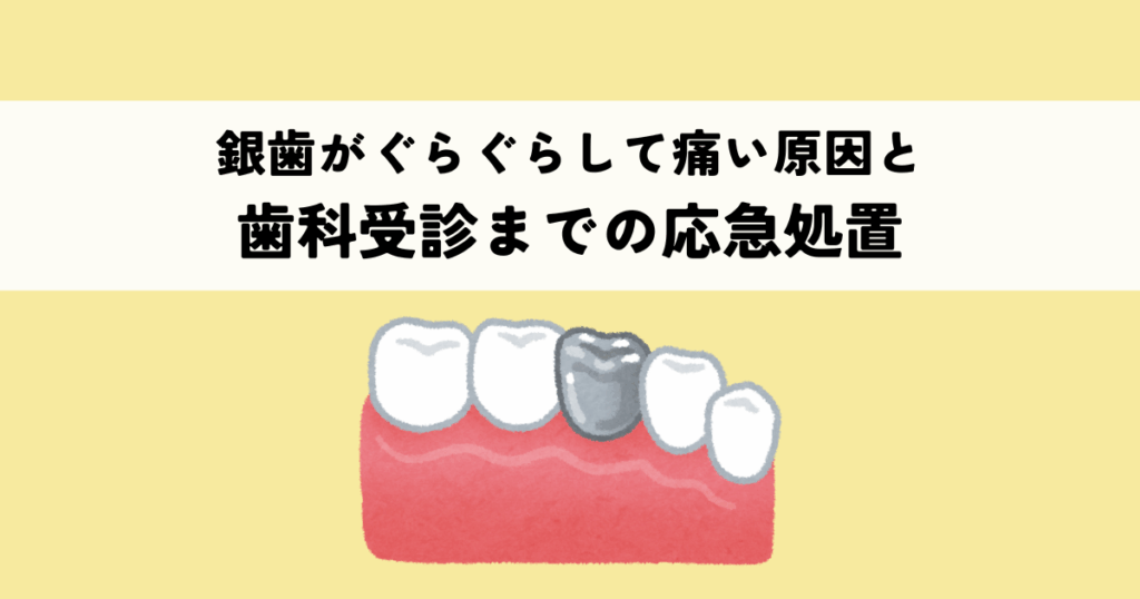 銀歯がぐらぐらして痛い原因と歯科受診までの応急処置