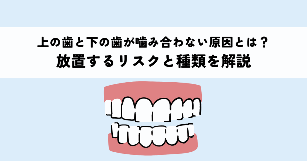 上の歯と下の歯が噛み合わない原因とは？放置するリスクと種類を解説