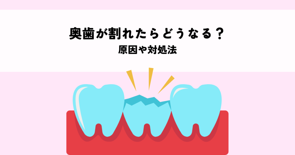 奥歯が割れたらどうなる？原因や対処法を解説