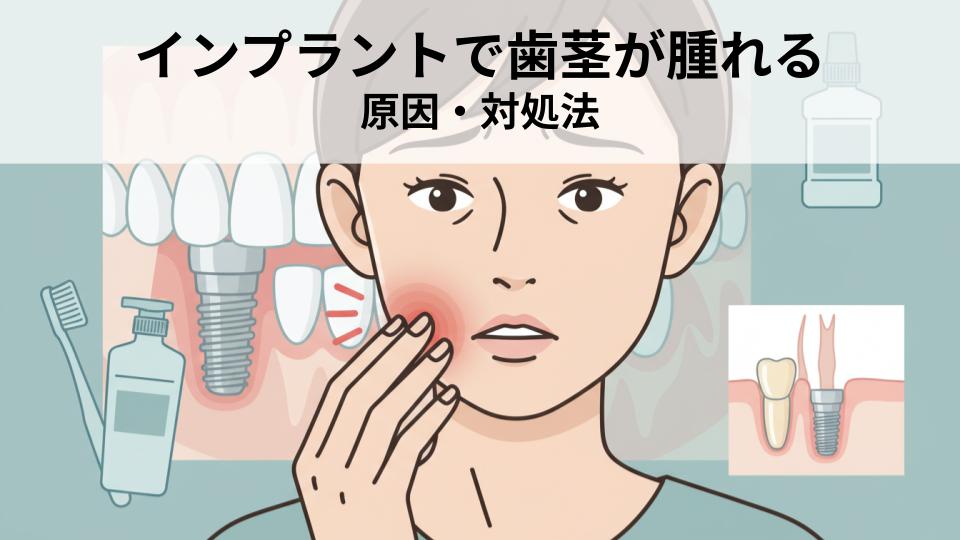 インプラントで歯茎が腫れる原因とは？対処法を解説
