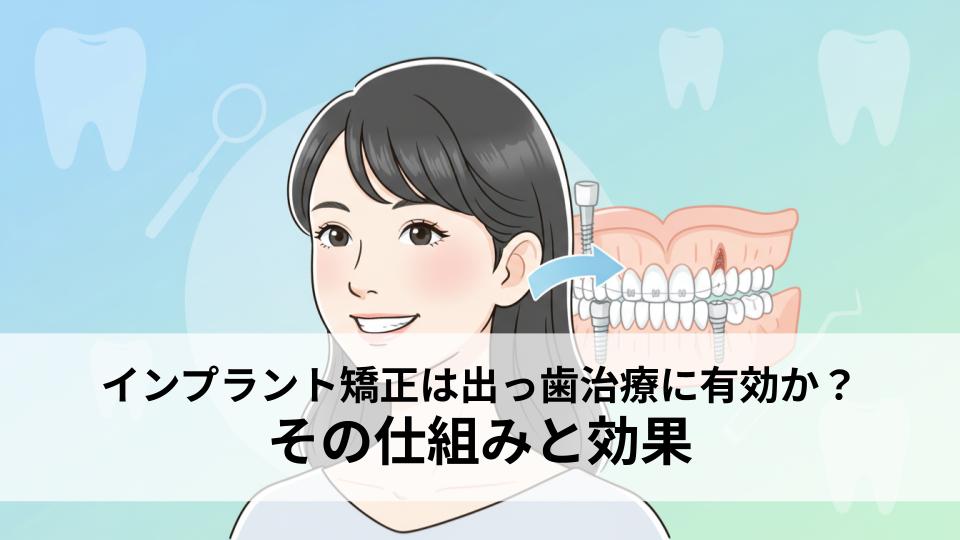 インプラント矯正は出っ歯治療に有効か？その仕組みと効果を解説