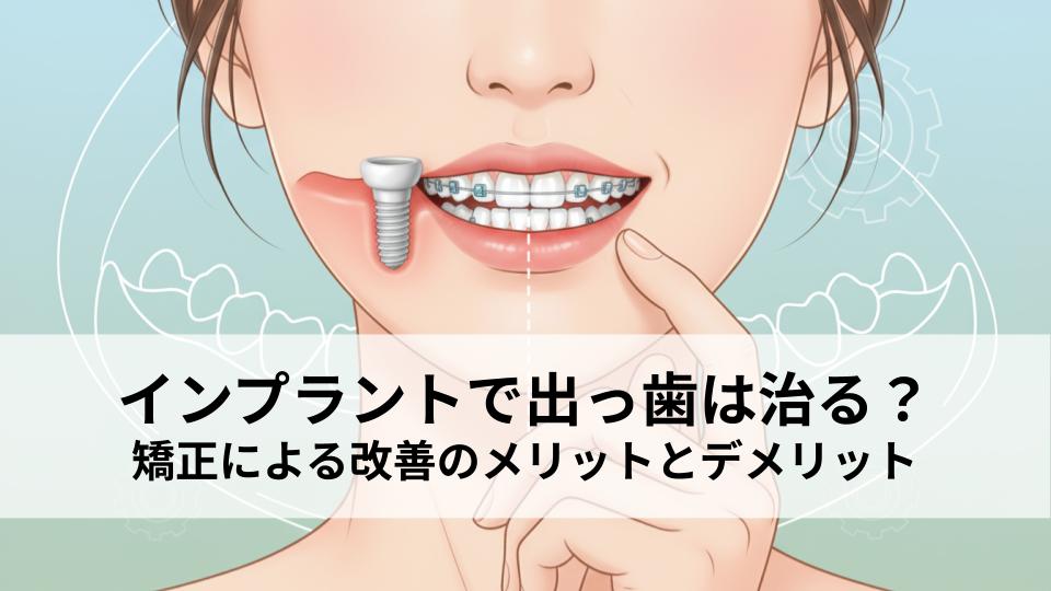 インプラントで出っ歯は治る？矯正による改善のメリットとデメリット